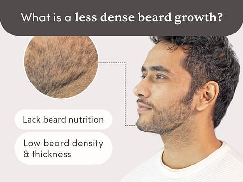 Man Matters Beardmax Growth Serum, Minoxidil 5% product packaging