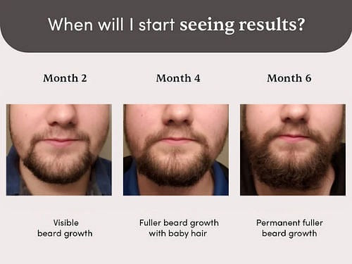 Man Matters Beardmax Growth Serum, Minoxidil 5% product packaging