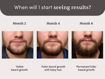 Man Matters Beardmax Growth Serum, Minoxidil 5% product packaging