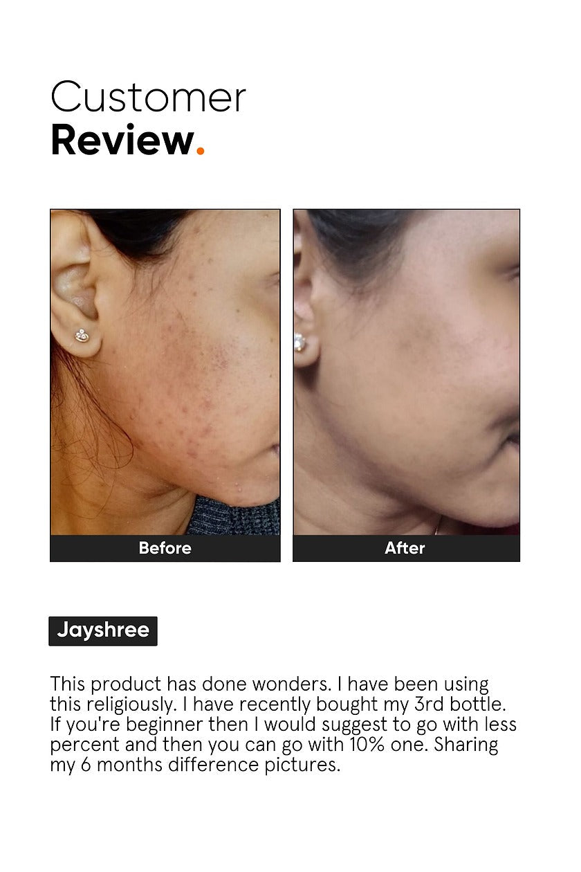 Minimalist 10% Niacinamide Face Serum product packaging