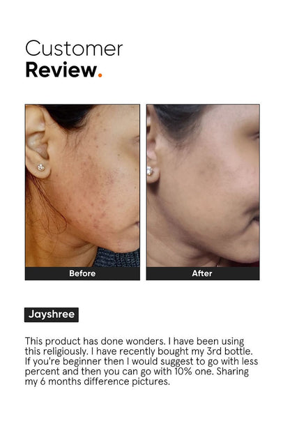 Minimalist 10% Niacinamide Face Serum product packaging